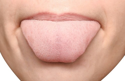 Hva merkene på tungen din kan bety