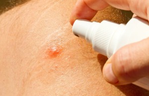 De beste hjemmelagde myggmidlene