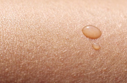 Hjemmelaget behandlinger for tørr hud