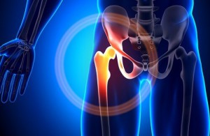 Mangel på kalsium - hvordan håndtere dette