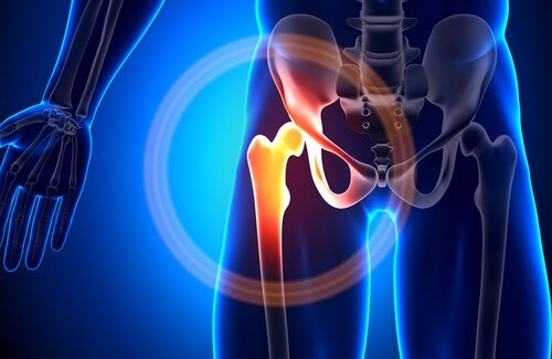 Mangel på kalsium - hvordan håndtere dette