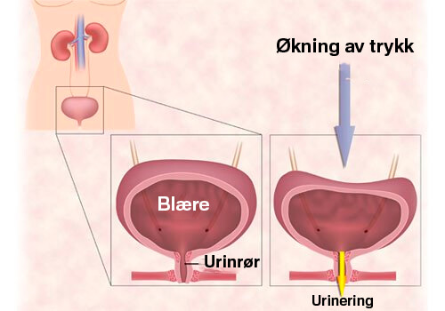 Øvelser for urininkontinens hos kvinner
