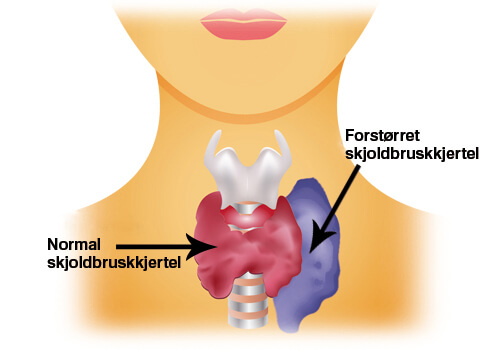 normal skjoldbruskkjertel