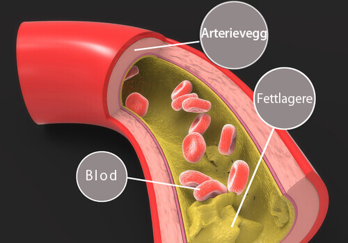 Mandelens kolesterolreduserende egenskaper