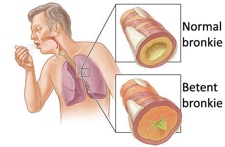 lunger vist på innsiden