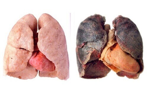 Råd for renere lunger