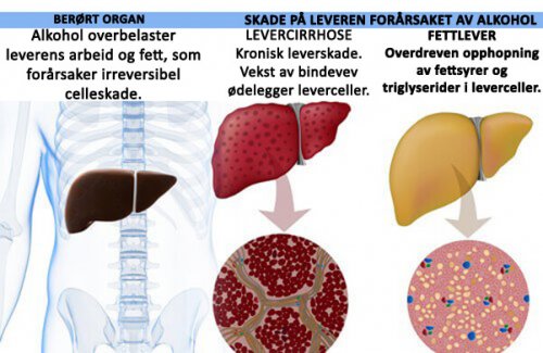 Effekten alkohol har på kroppen
