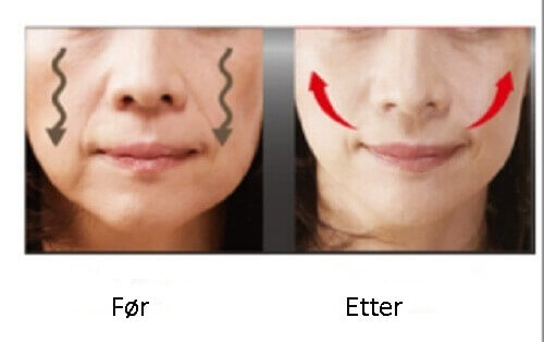 Få myke og stramme kinn med disse 4 tipsene