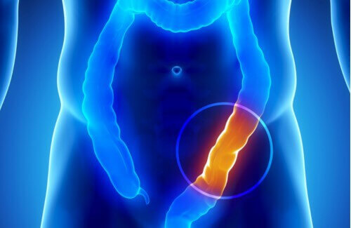 8 ting du burde vite om tykktarmen