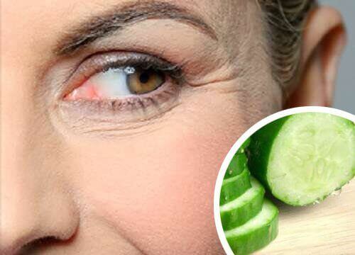 Naturlige tips som vil redusere rynker