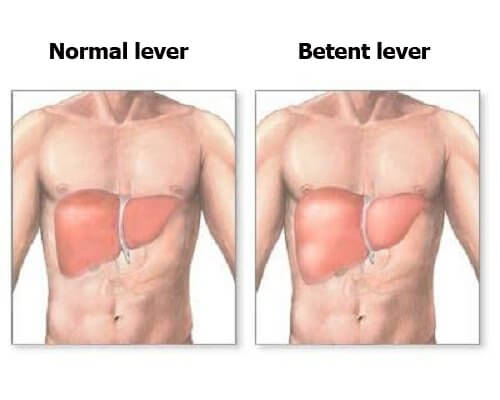 Betent lever: er leveren din betent?