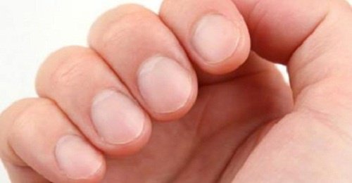 8 varseltegn fra neglene dine
