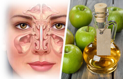 eplecidereddik for bihulebetennelse