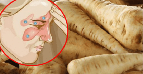 Hvordan du blir kvitt en bihulebetennelse på 5 dager