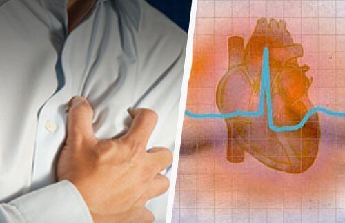 Hjertearytmi: symptomer og konsekvenser