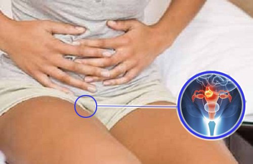 Faresignaler på livmorhalskreft