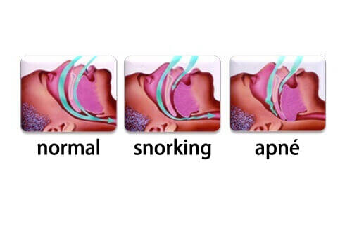 Hvordan kan du slutte å snorke?