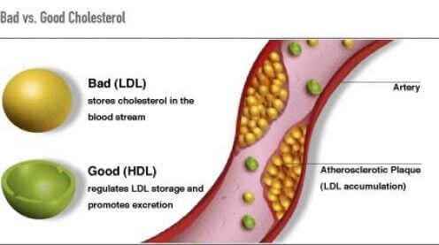 kolesterol