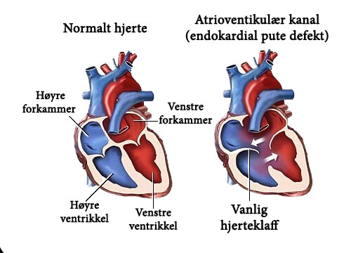 7 symptomer på bilyder på hjertet du bør vite om