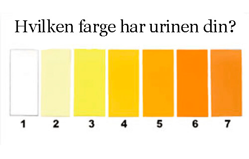 8 typer urin som kan fortelle deg noe om helsen din