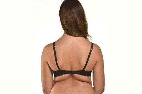 Bli kvitt kjærlighetshåndtak på ryggen