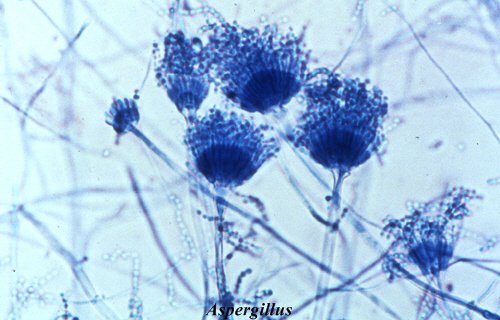 aspergillus er en muggsopp