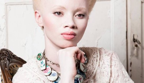 Livet som albino: Møt modellen Thando Hopa