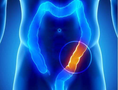 Dårlig tarmhelse ved 90% av sykdommer