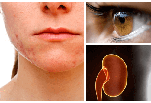 Disse organene skades mest av et høyt stressnivå