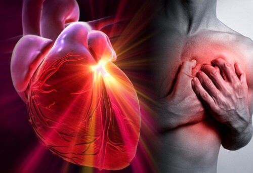 Slik kan man redusere risikoen for hjerteinfarkt eller slag