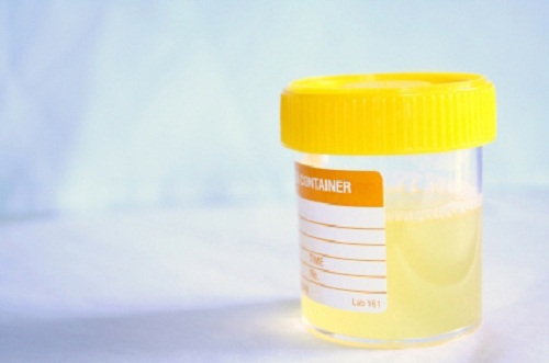 Hvordan forebygge urinveisinfeksjoner
