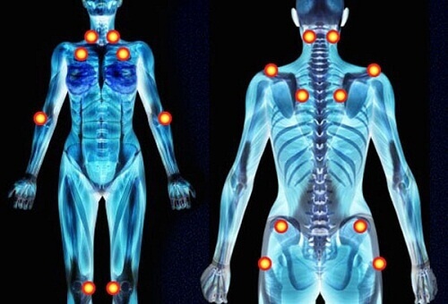 Lindre fibromyalgi ved hjelp av medisinske urter