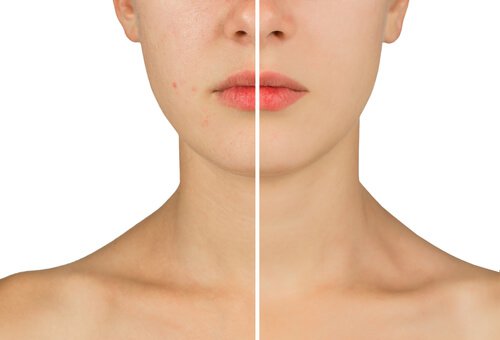 Bruk hydrogenperoksid