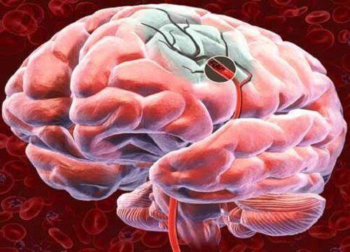 Oppdag 5 måter å øke blodtilførselen til hjernen på