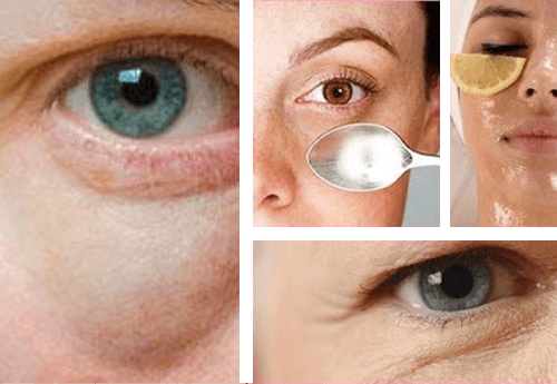 Enkle tips for å bekjempe poser under øynene