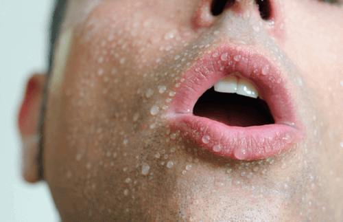 Overdreven svetting er et ubehagelig problem