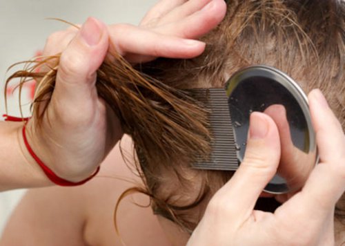 7 naturlige og effektive behandlinger mot lus og luseegg