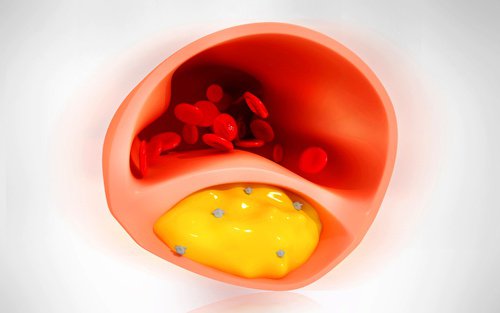 8 matvarer som renser blodårene