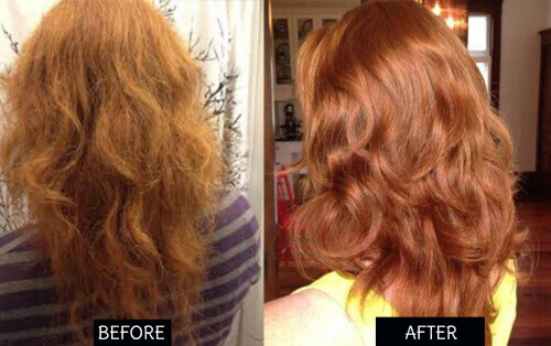 hår før og etter