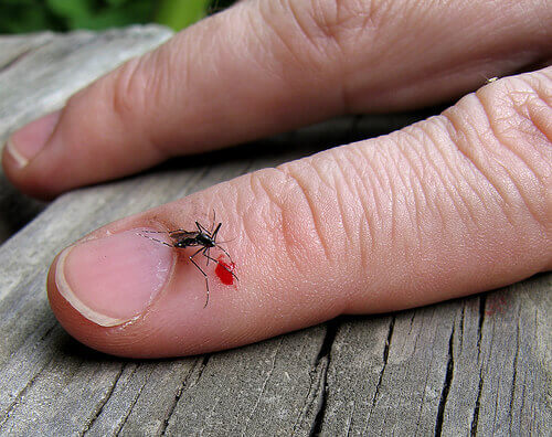 insect-bites