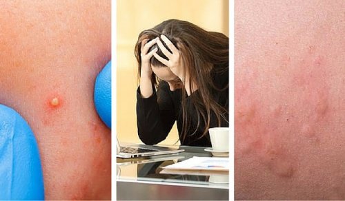 7 ting som indikerer at stressnivået ditt er for høyt