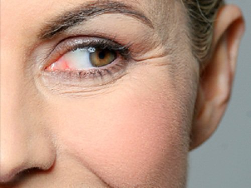 8 kosmetiske bruksområder for eplecidereddik