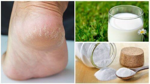Mykere føtter med bare to naturlige ingredienser Mykere føtter med bare to naturlige ingredienser