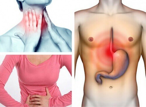 Lider du av gastroøsofageal refluks?