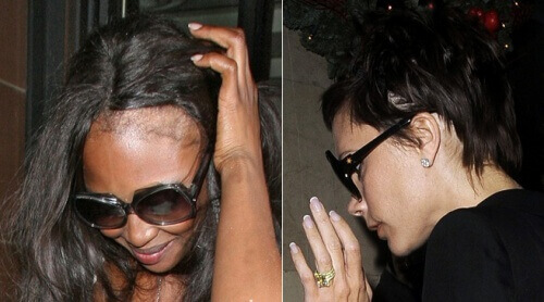 5 tips for å skjule tynt hår