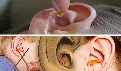 Hvordan fjerne ørevoks på en naturlig måte