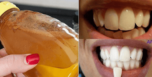 Blek tennene dine med en 100% naturlig ingrediens