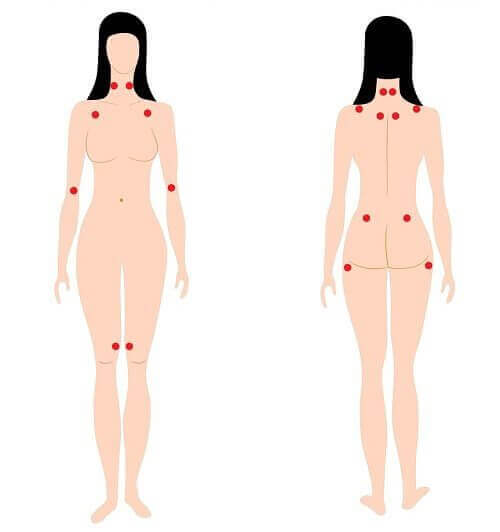 2-fibromyalgi
