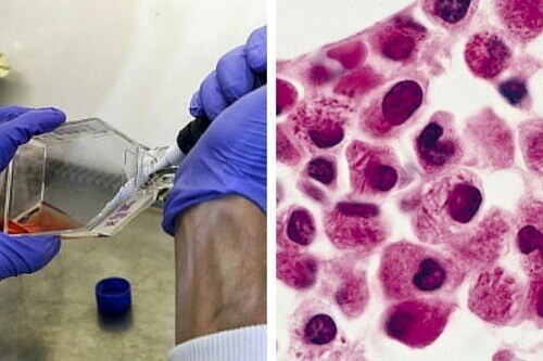Ny oppdagelse får leukemiceller til å ødelegge seg selv