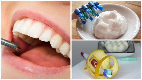 5 remedier for å fjerne plakk fra tennene